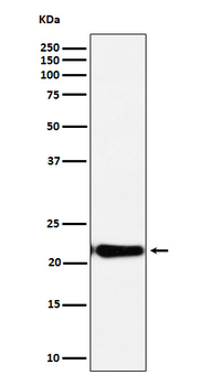 DNPH1 Rabbit Monoclonal Antibody