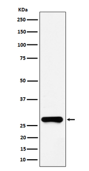 GSTO1 Rabbit Monoclonal Antibody