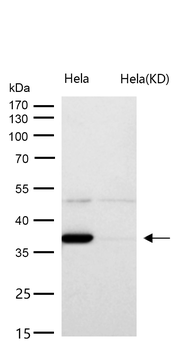 ACAT2 Rabbit Monoclonal Antibody