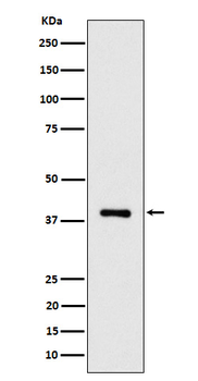 ACAT2 Rabbit Monoclonal Antibody
