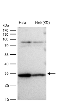 ARPC2 Rabbit mAb [KD Validated] Antibody