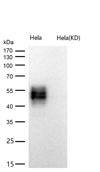 CD58 Rabbit mAb [KD Validated]