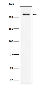 CHD3 Rabbit mAb [KD Validated]