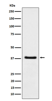 HDGF Rabbit mAb Antibody
