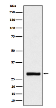BRMS1 Rabbit mAb [KD Validated]