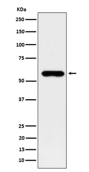 SUOX Rabbit Monoclonal Antibody