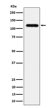 UBE4A Rabbit mAb Antibody