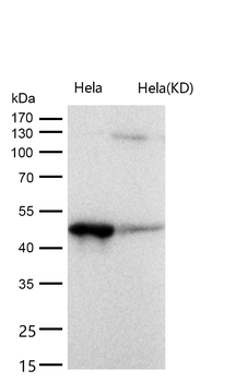 ACAA2 Rabbit mAb [KD Validated]