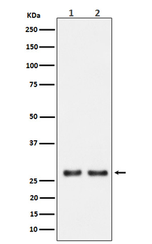 UPP1 Rabbit Monoclonal Antibody
