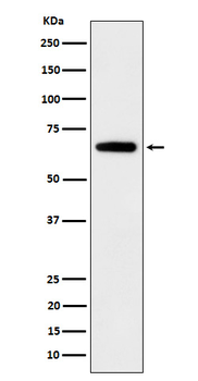 IGF2BP2 Rabbit Monoclonal Antibody