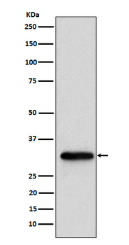 NUDT5 Rabbit Monoclonal Antibody