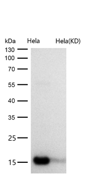AP2S1 Rabbit mAb [KD Validated]