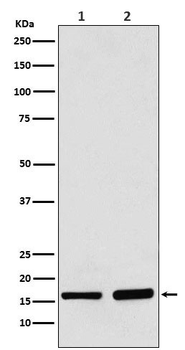 AP2S1 Rabbit mAb [KD Validated]