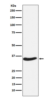 EXOSC7 Rabbit mAb Antibody