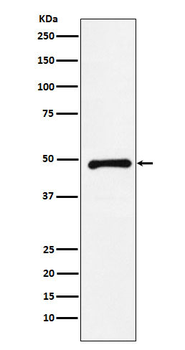 CTBP2 Rabbit mAb Antibody