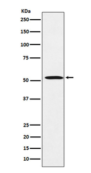 FADS1 Rabbit Monoclonal Antibody