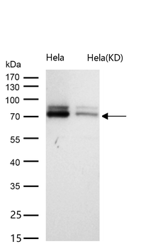 FACL4 Rabbit mAb [KD Validated]
