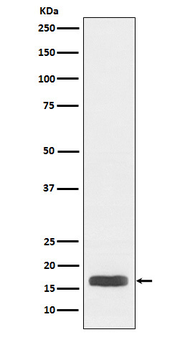 Histone H3 (acetyl K27) Rabbit mAb [KD Validated]