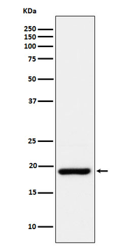 CIRBP Rabbit mAb [KD Validated]