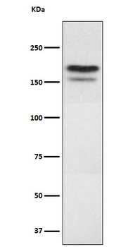 EHMT2 Rabbit mAb [KD Validated]
