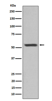 Cytokeratin 12 Rabbit mAb Antibody