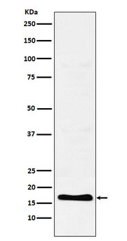TFF2 Rabbit mAb Antibody