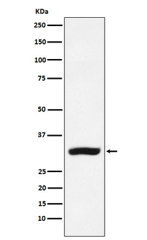 CBR1 Rabbit Monoclonal Antibody