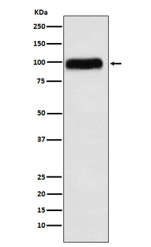 SERPING1 Rabbit Monoclonal Antibody