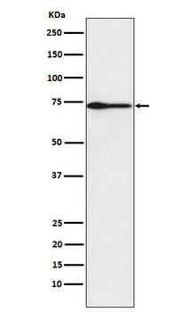 PROS1 Rabbit Monoclonal Antibody