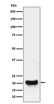 DCTN5 Rabbit mAb Antibody