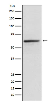 KLC1 Rabbit mAb Antibody