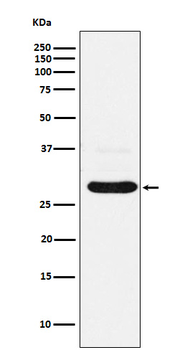 CHMP2B Rabbit mAb [KD Validated]