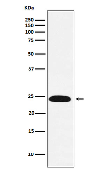 VPS28 Rabbit mAb Antibody