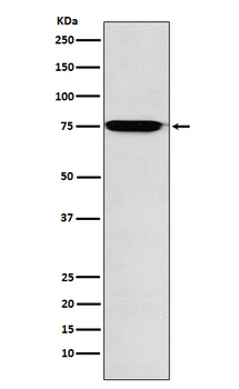 GAA Rabbit Monoclonal Antibody