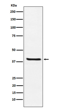 Arg2 Rabbit mAb [KD Validated] Antibody
