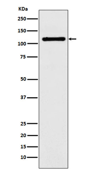 DPYD Rabbit mAb Antibody