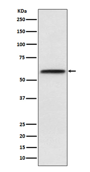 LCAT Rabbit Monoclonal Antibody