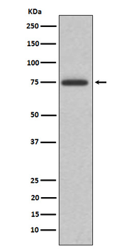 ABI2 Rabbit Monoclonal Antibody
