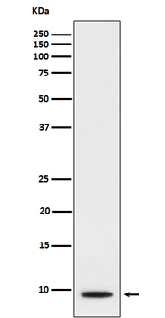 CXCL5 Rabbit mAb