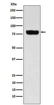 SLC22A3 Rabbit mAb Antibody