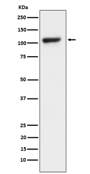 KDM1 / LSD1 Rabbit mAb Antibody