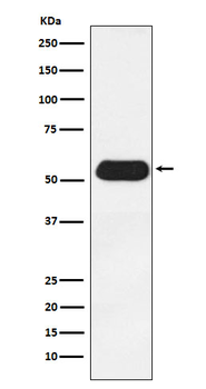 ESRRG Rabbit Monoclonal Antibody