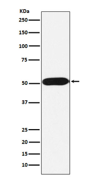 FKBP38 Rabbit mAb Antibody