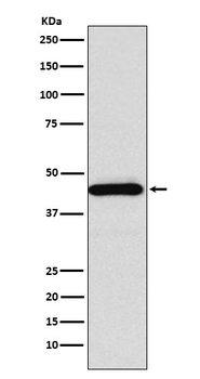 SSTR5 Rabbit Monoclonal Antibody