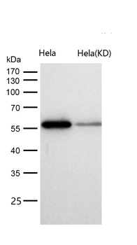 DLDH Rabbit mAb [KD Validated] Antibody