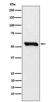 DLDH Rabbit mAb [KD Validated] Antibody