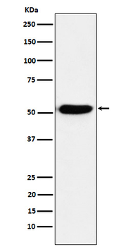IRF4 Rabbit Monoclonal Antibody