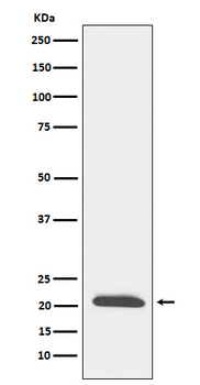 DCTN3 Rabbit mAb Antibody