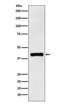 IL12 p40 Rabbit Monoclonal Antibody