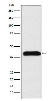 M6PR Rabbit mAb Antibody